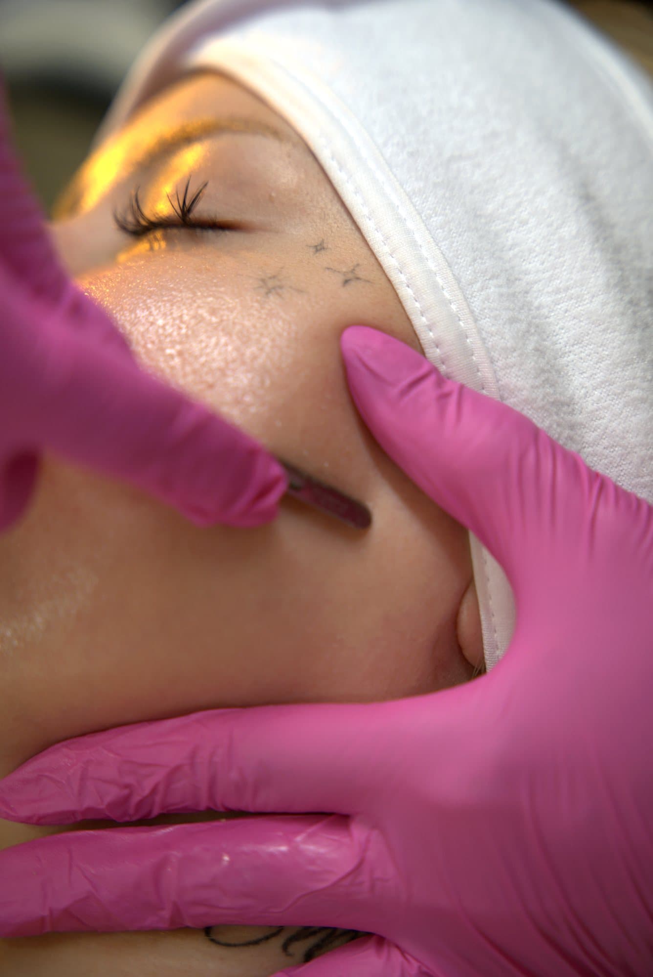 Esteticista con guantes rosas haciendo dermaplaning en la mejilla durante un facial